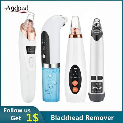 Electric Blackhead Remover